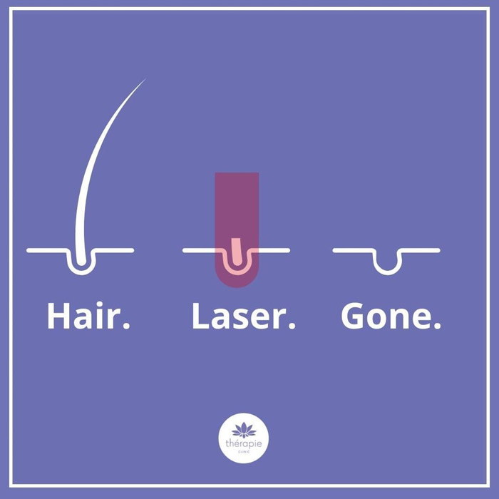 Find out about Thérapie Clinic’s Laser Hair Removal pre - Summer sale today