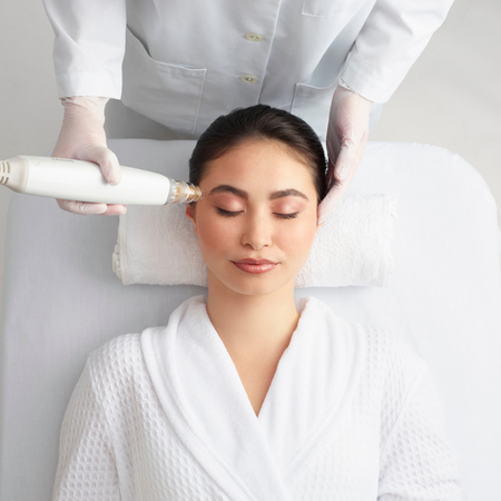 World’s First Radiofrequency Microneedling treatment
