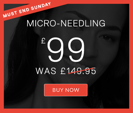 Microneedling Special Offers